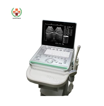 SY-A032-1 2 sondy, 3d 4d 5d farba dopplerov ultrazvuk stroj Prenosný ultrazvuk skener prenosný kavitačný ultrazvuk stroj